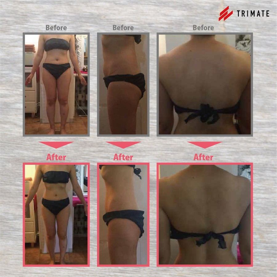 楽天市場】Magie Plan マギープラン 塗るだけ 業務用痩身 ボディジェル