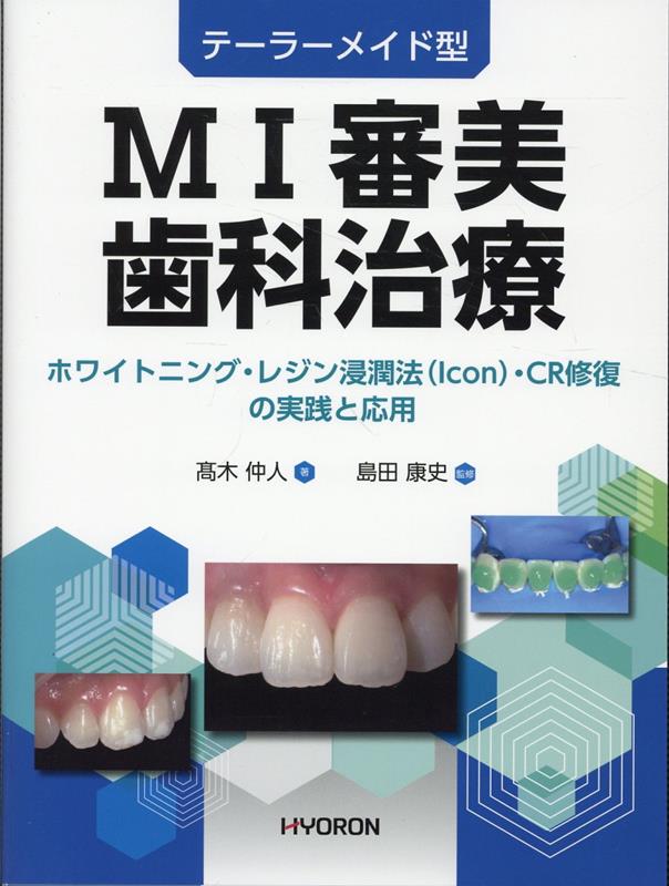 楽天ブックス: テーラーメード型MI審美歯科治療 - 高木仲人