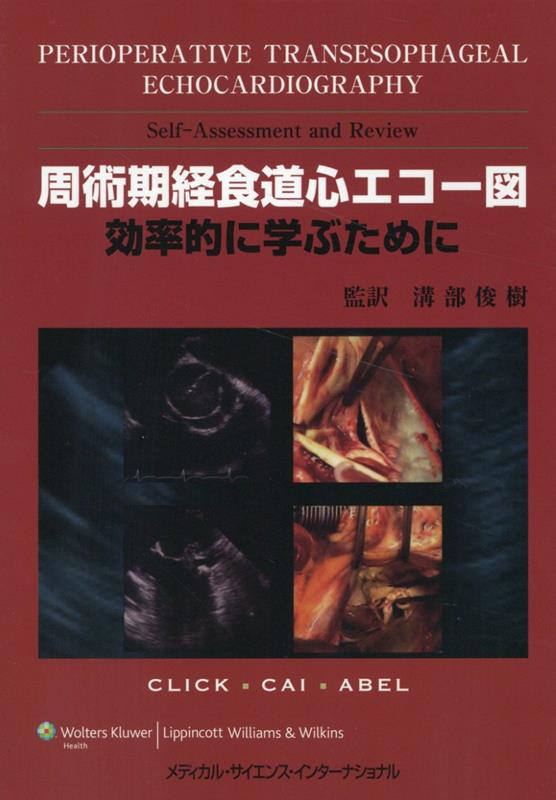 楽天市場】周術期経食道心エコー図 効率的に学ぶために（本・雑誌