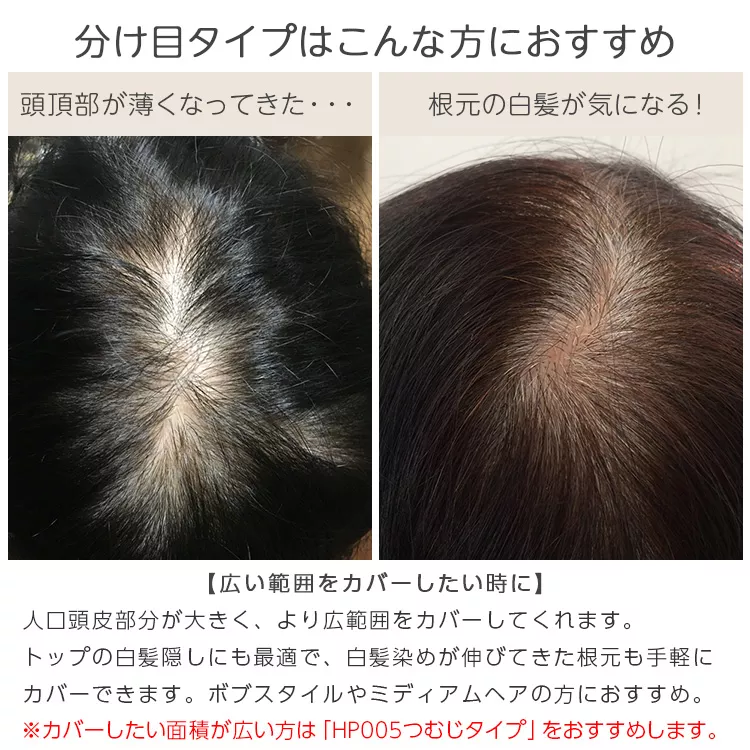 マシンメイド 最高級人毛(レミー)100％ トップヘアピース分け目タイプ