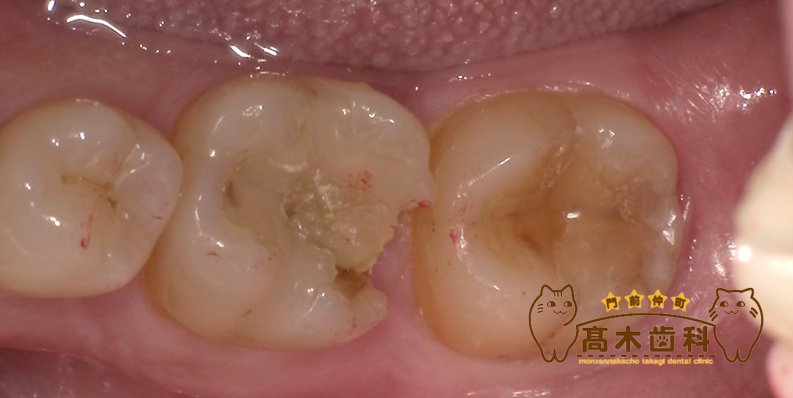 審美歯科｜門前仲町・木場の歯医者【門前仲町髙木歯科】