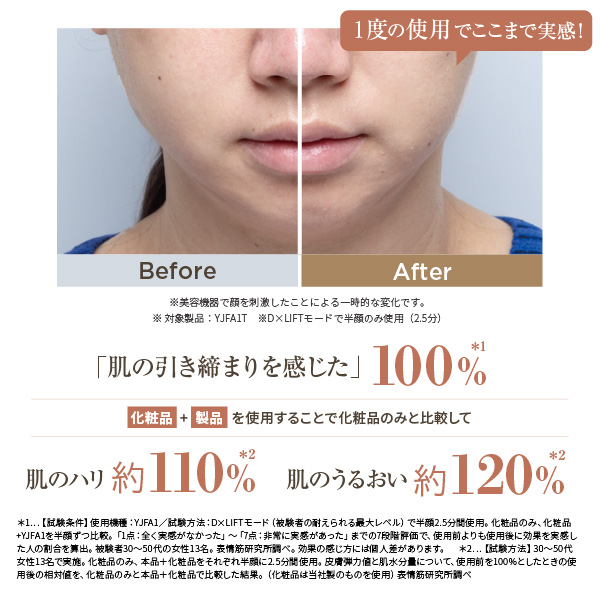 お取引先様ご優待対象】フォトプラス ディープリフト｜ヤーマン公式