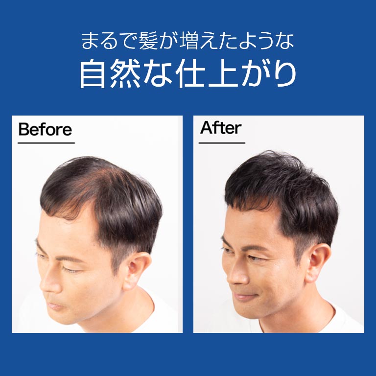 スーパーミリオンヘアー 30g 単品 【通常】｜nihonchokuhan(日本直販