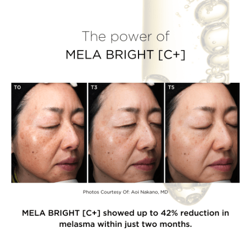 メラブライトC+｜シミの原因メラニンを抑制するシステアミン配合の美容