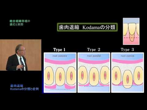 プラスティックサージェリーを究める② 結合組織移植＆インプラント