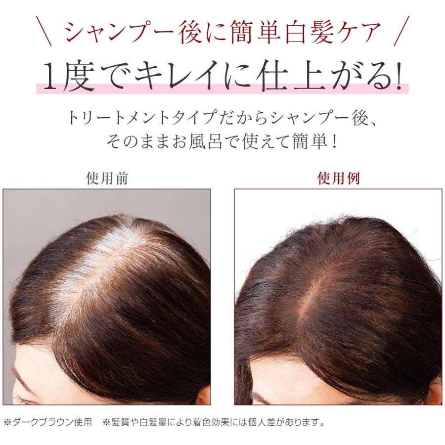 ビューナ 白髪染め ヘアカラートリートメント ダークブラウン 白髪