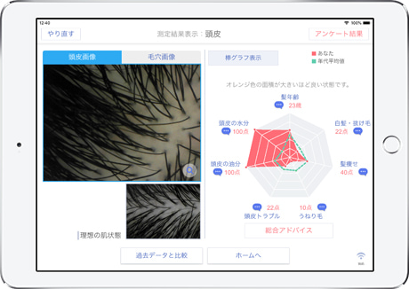 Smart Skin Care-スマートスキンケア-プロ仕様の肌・頭皮・髪測定を1台