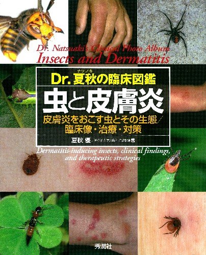 Dr.夏秋の臨床図鑑 虫と皮膚炎 | 夏秋優 |本 | 通販 | Amazon
