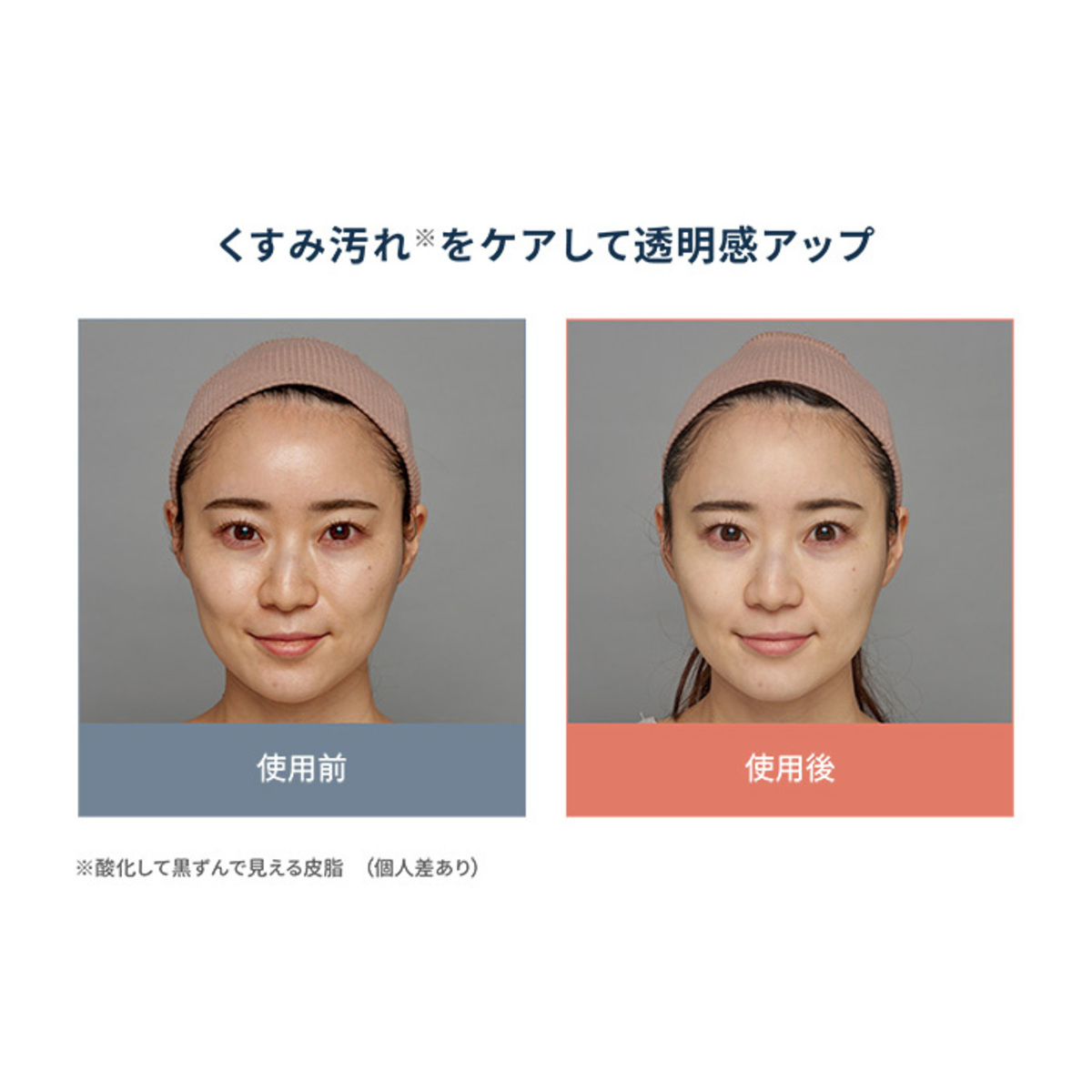 MA・SHIROエクストラリッチ フェイストリートメント200g マシロ（MA