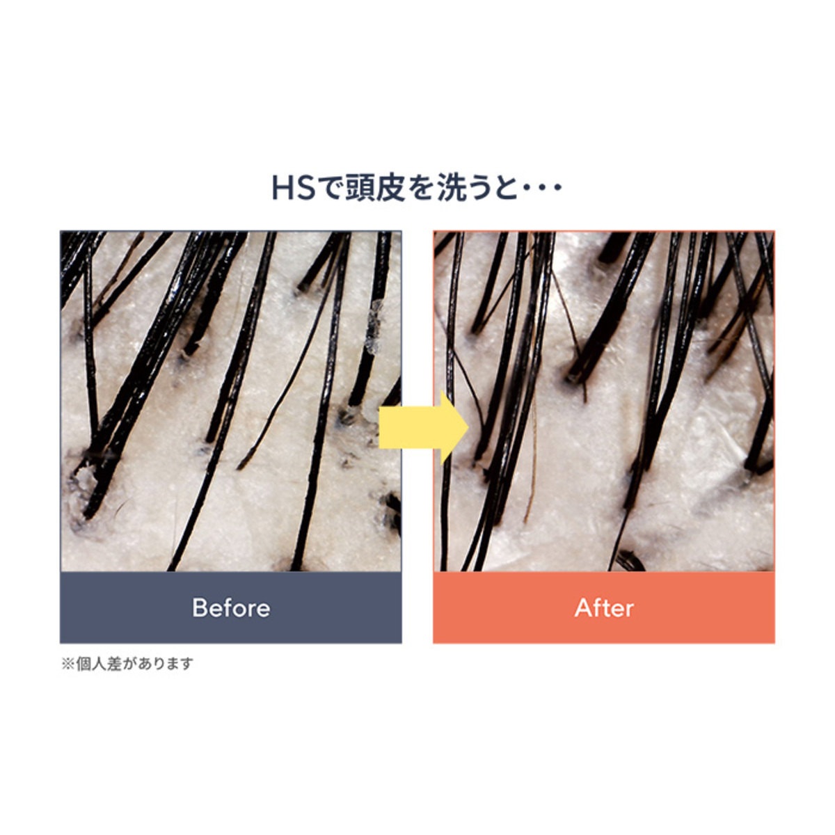 J.AVEC TOI バイタライジングHS-III 3個 特別セット ジェイアベック