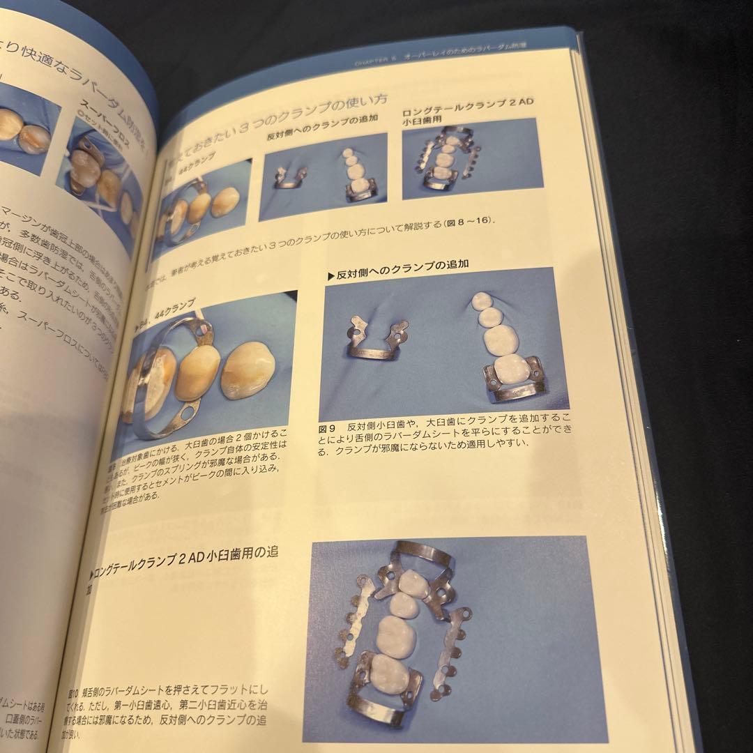 オーバーレイ修復 超入門