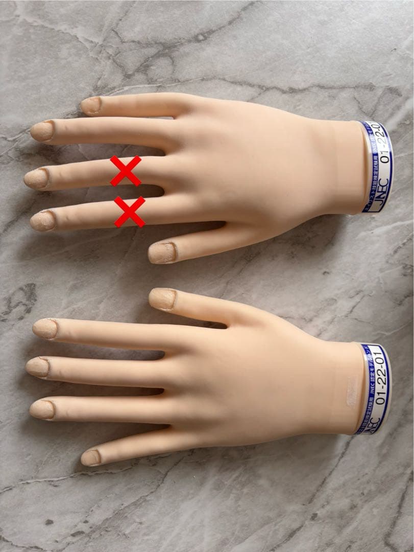 認定ハンド 両手 右手骨折2本有り 認定ハンド 両手 右手骨折2本有り 認定ハンド 両手 右手骨折2本有り