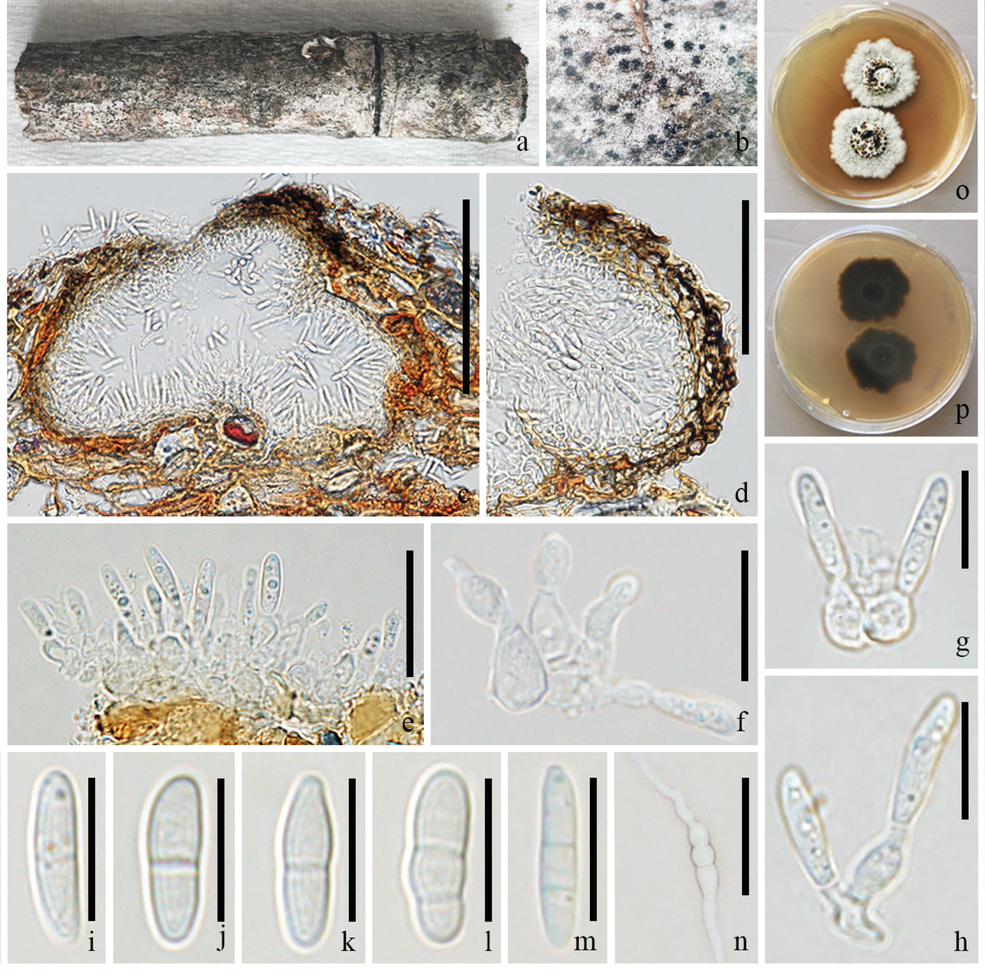 Taxonomy and phylogeny of Pseudochaetosphaeronema associated with