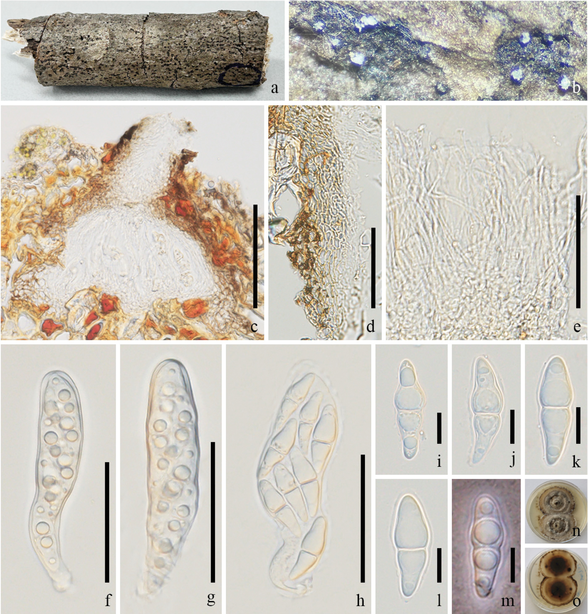Taxonomy and phylogeny of Pseudochaetosphaeronema associated with